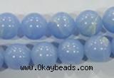 CTU1737 15.5 inches 16mm round synthetic turquoise beads